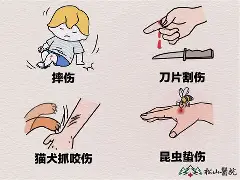 九游体育下载app-关于艠N?TuG囙傷_怙Q0S蝅轆璔B的信息